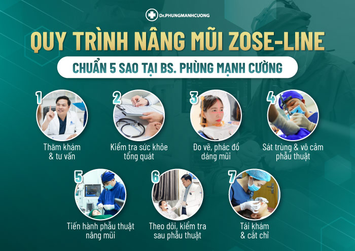 Quy trình nâng mũi Zose - Line tại bác sĩ Phùng Mạnh Cường