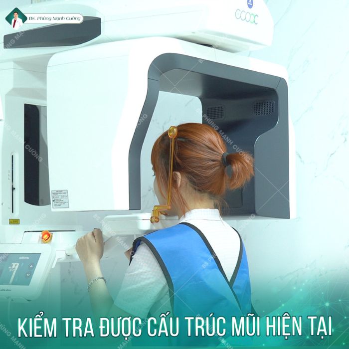 Ứng dụng công nghệ X-Quang AI vào phương pháp nâng mũi Zose - Line