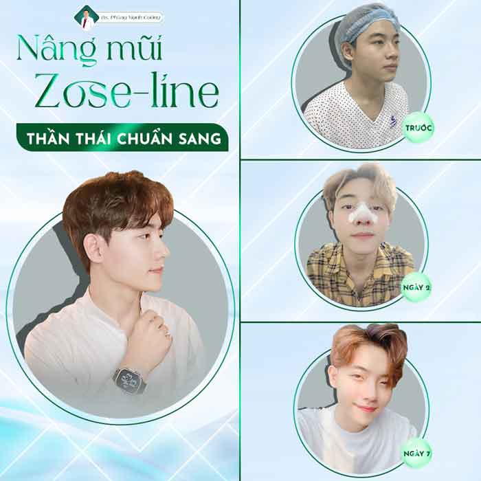 nang mui zose line 6