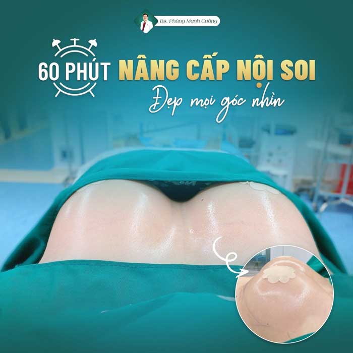 Nâng ngực nội soi tại BS Phùng Mạnh Cường - Đẹp mọi góc nhìn