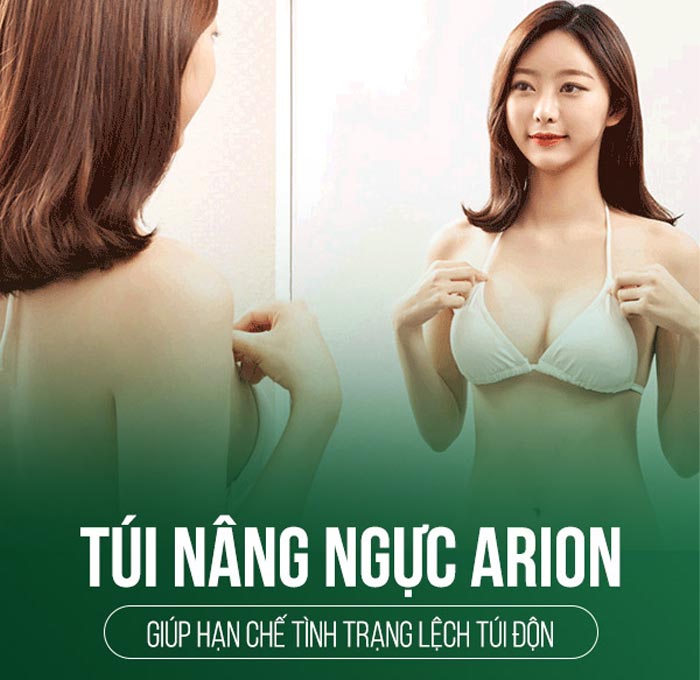 Nâng Ngực Túi Arion Vi Nhám Chuẩn Hàn Tại Việt Nam 21 nang nguc tui arion 2