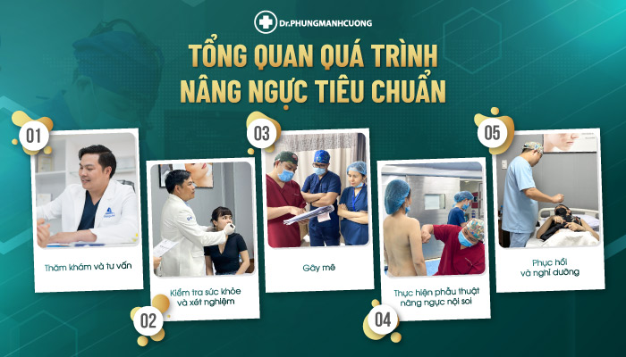 Tổng quan quá trình nâng ngực tiêu chuẩn