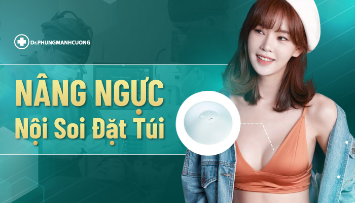 Nâng ngực nội soi đặt túi