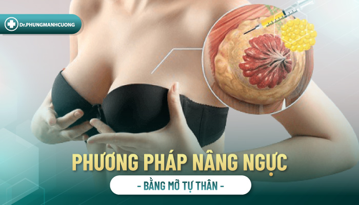 Nâng ngực bằng mỡ tự thân