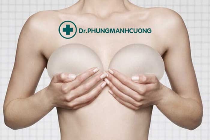 Ngực bị lộ túi độn, nhìn không được tự nhiên