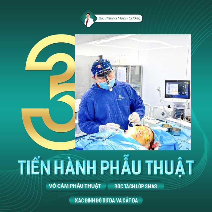 quy trinh cang da mat 2