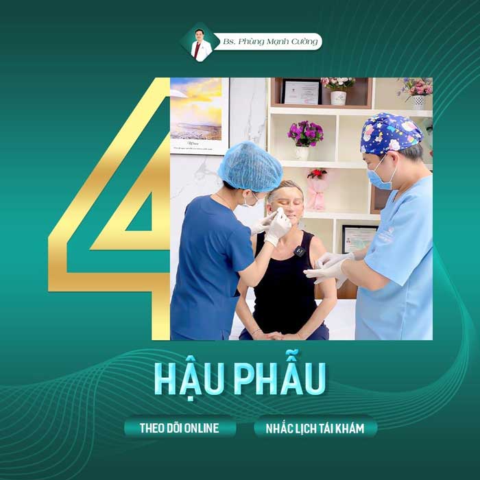 quy trinh cang da mat 3