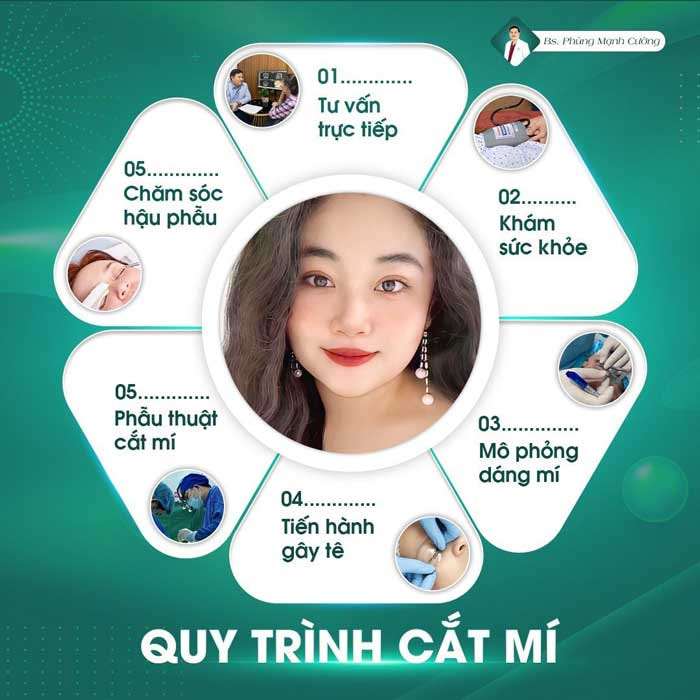 Quy trình thẩm mỹ mắt tại BS Cường chuẩn Y Khoa