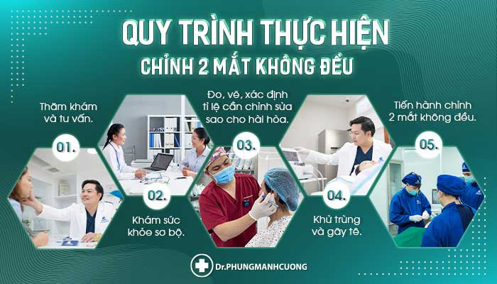 Quy trình chỉnh 2 mắt không đều tại BS Cường chuẩn an toàn