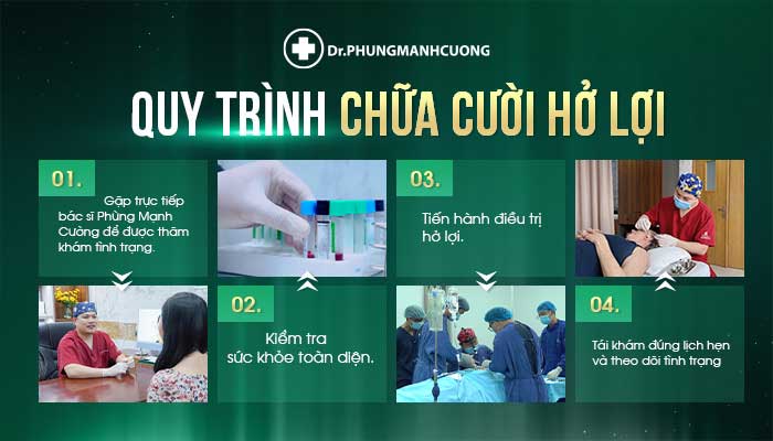 Quy trình chữa cười hở lợi tại BS Phùng Mạnh Cường