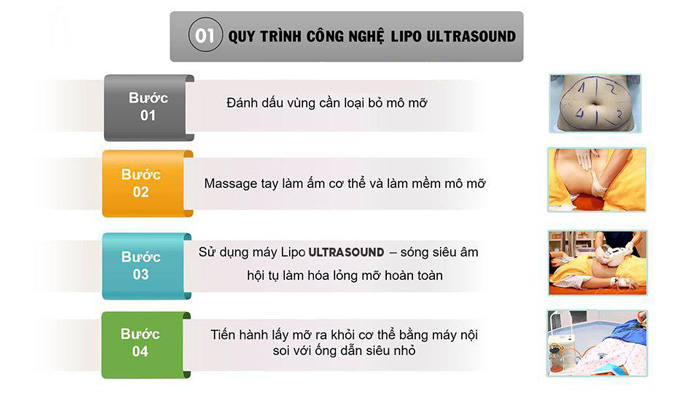 Quy trình giảm béo lipo ultrasound