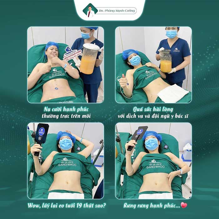 Các khách hàng đều hài lòng sau khi thực hiện hút mỡ lựng tại BS Phùng Mạnh Cường