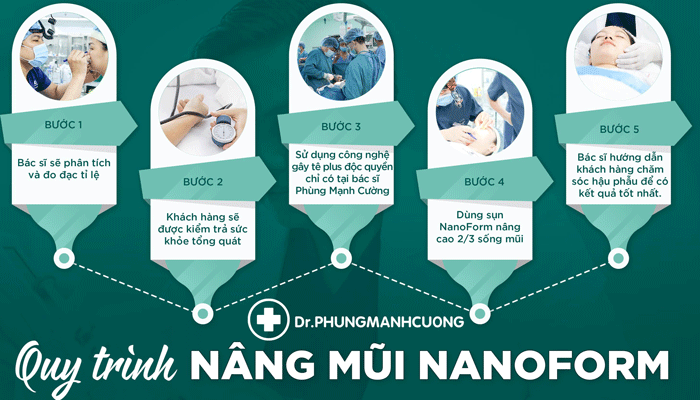 Quy trình nâng mũi nanoform tại bác sĩ phùng mạnh cường