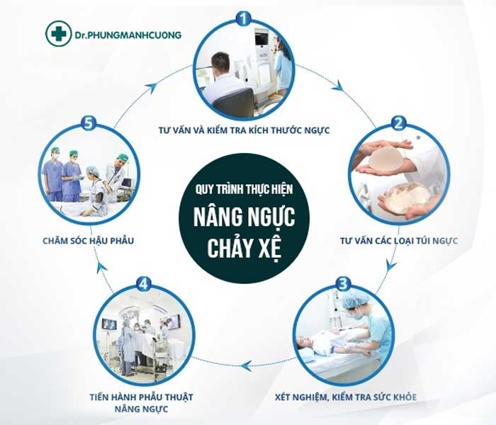 Quy trình thực hiện treo ngực sa trễ tại BS Phùng Mạnh Cường