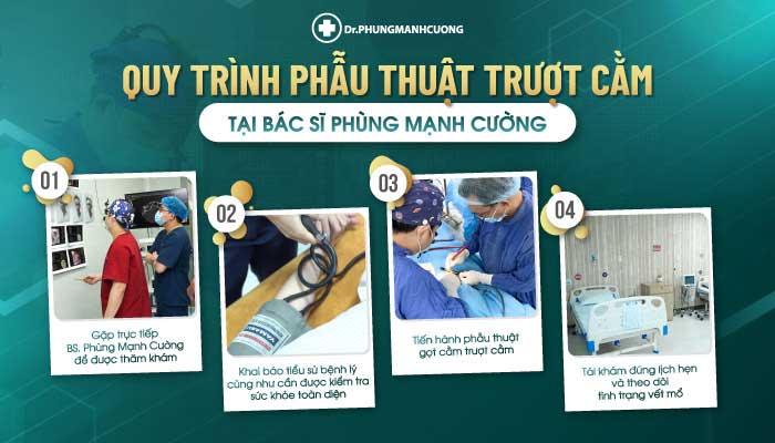  QUY TRÌNH PHẪU THUẬT TRƯỢT CẰM TẠI BS PHÙNG MẠNH CƯỜNG