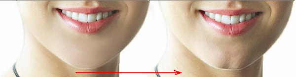 Tạo Cằm Chẻ - Bí Quyết Làm Đẹp Cho Gương Mặt Sắc Sảo Và Thu Hút 7 Tạo Cằm Chẻ Là Xu Hướng Làm Đẹp Mới