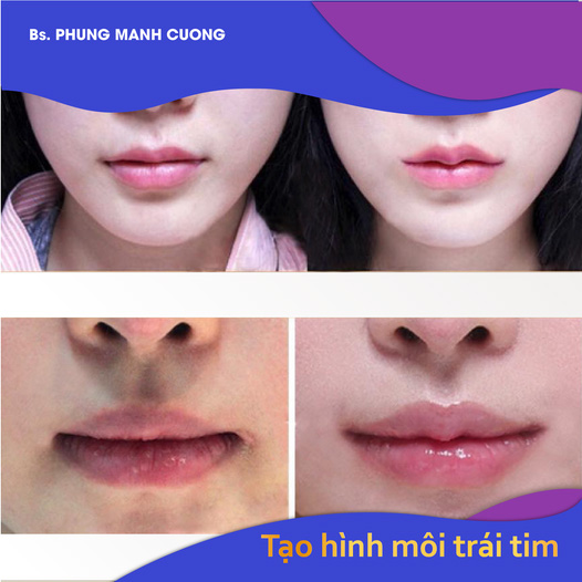 Tạo Hình Môi Trái Tim - Nhìn Là Muốn Hôn