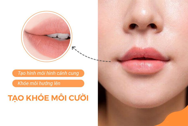 Tạo Khóe Môi Cười Làm Khuôn Mặt Luôn Tươi Tắn Rạng Ngời 20 Tạo Khóe Môi Cười Làm Khuôn Mặt Thêm Xinh