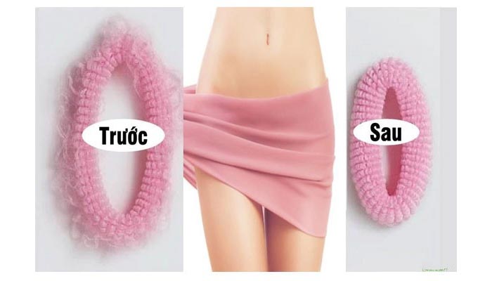 Thu Cơ Âm Đạo - "Cô Bé" Tự Tin Đối Mặt "Cậu Nhỏ"