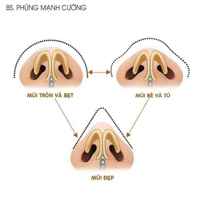 thu gon canh mui 6 1