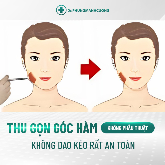 Phương phày không dùng dao kéo nhưng vẫn sở hữu gương mặt V Line