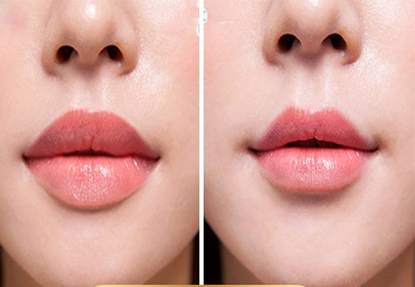 Thu Mỏng Môi + Tạo Hình Môi