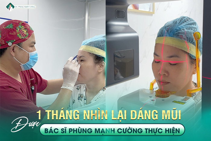 BS Cường phân tích hình X quang AI điện toán trước khi PTTM cho KH