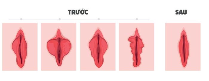 thu nho moi be moi lon 2 1