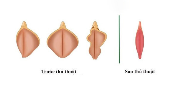 Thu Nhỏ Môi Bé Môi Lớn An Toàn