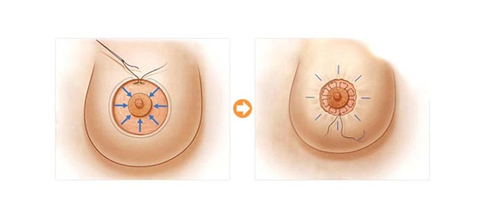 thu nho quang vu 4 1