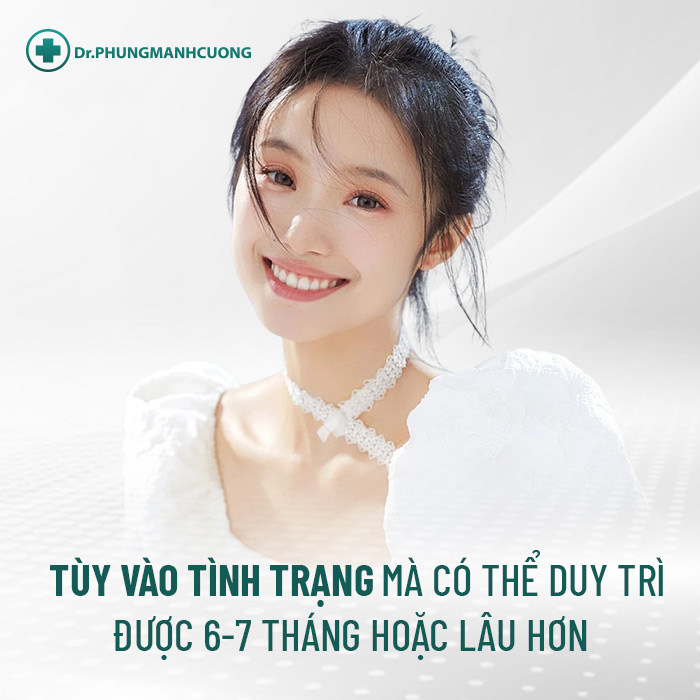 Tùy vào nhiều yếu tố mà kết quả thon gọn góc hàm có thể duy trì bao lâu