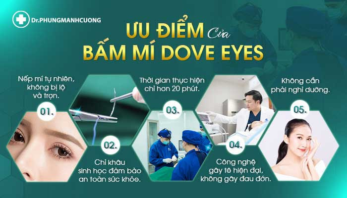 Các ưu điểm của bấm mí Dove Eyes