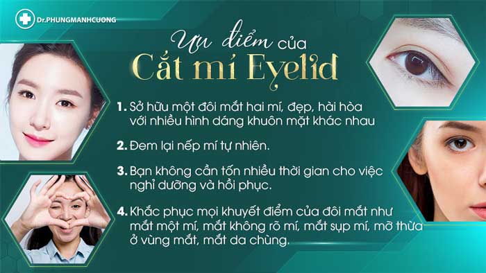 Cắt Mí (Eyelid) - Xây Dựng Diện Mạo "Bạc Tỷ" 18 Ưu điểm của phương pháp cắt mí Eyelid tại BS Cường