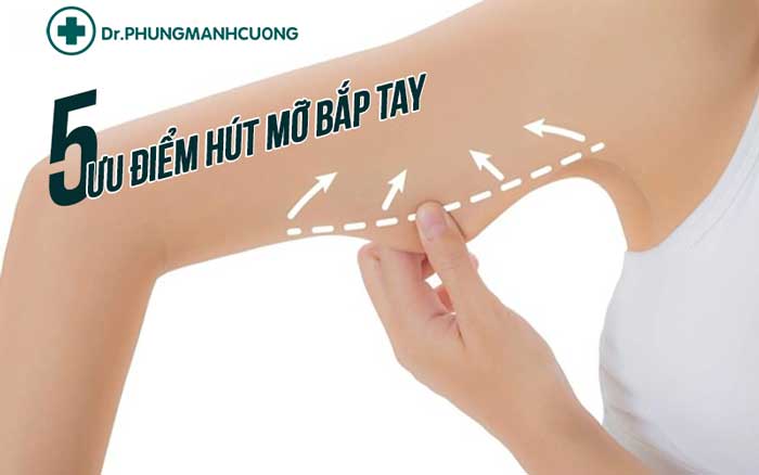 5 ưu điểm vượt trội khi thực hiện hút mỡ bắp tay tại BS Phùng Mạnh Cường