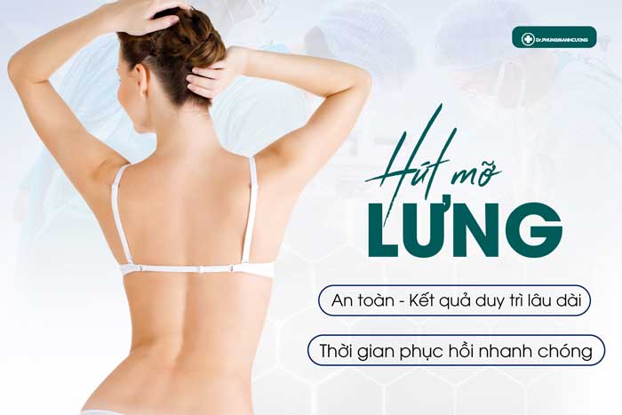 Những ưu điểm vượt trội của hút mỡ Lưng tại BS Cường