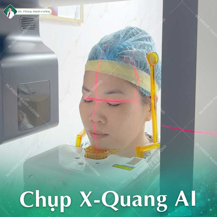 Các dịch vụ về mũi sẽ được chụp X-Quang AI điện toán
