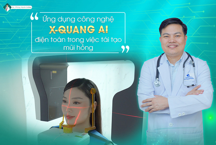 Chỉnh Dị Tật Mũi - Giải Pháp "Cứu Cánh" Cho Mũi Biến Dạng 15 BS Cường phân tích hình X quang AI điện toán trước khi PTTM cho KH