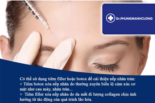 Xóa Nhăn Cơ Trán Hiệu Quả