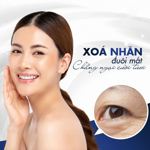 Công Nghệ Xóa Nhăn Đuôi Mắt Mới Không Cần Phẫu Thuật 8 Xóa Nhăn Đuôi Mắt Giúp Gương Mặt Trẻ Trung