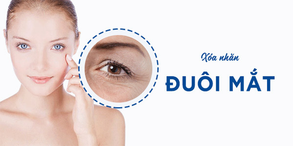 Công Nghệ Xóa Nhăn Đuôi Mắt Mới Không Cần Phẫu Thuật 6 Công Nghệ Xóa Nhăn Đuôi Mắt Mới Không Cần Phẫu Thuật