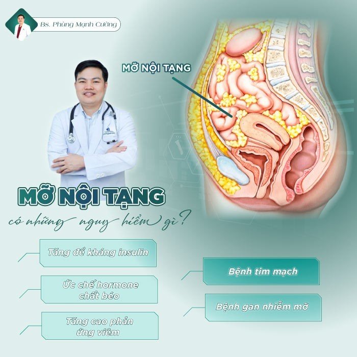 Mỡ nội tạng có nguy hiểm tiềm ẩn nếu không khắc phục kịp thời