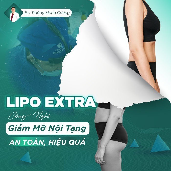 Phương pháp giảm mỡ nội tạng mới, an toàn và hiệu quả